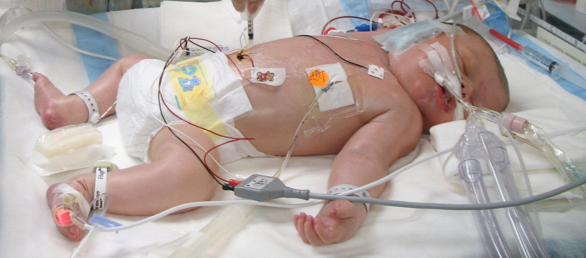 A Resperatory Therapist treating a newborn child Pulaski County Technical College Respiratory Therapist Program (cropped)